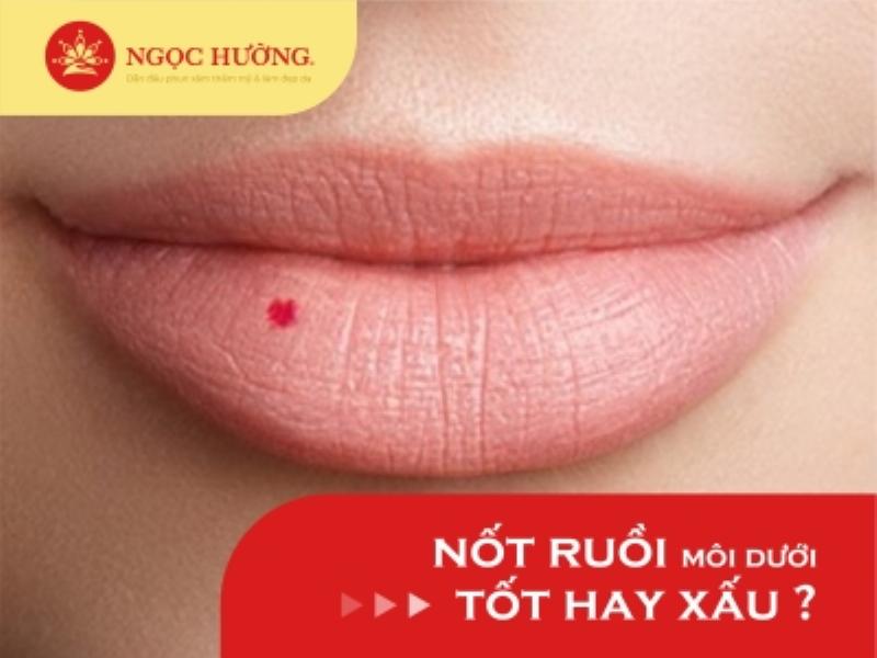 Câu chuyện thực tế về nốt ruồi ở môi trên