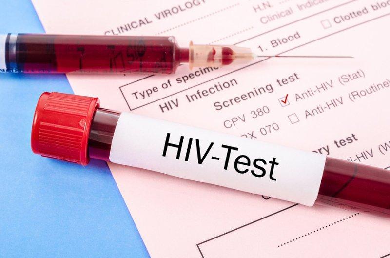 7 Dấu Hiệu Nhiễm HIV Ban Đầu Ở Nam Giới