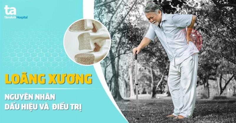 Cấu trúc xương bị loãng xương