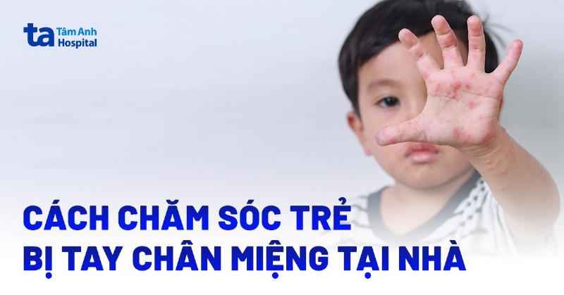 Chăm sóc bé bị tay chân miệng tại nhà