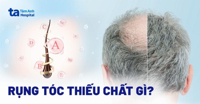 Dấu hiệu rụng tóc do thiếu vitamin