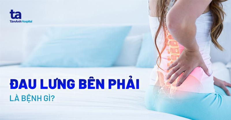 Đau lưng bên phải phía trên gần vai: Nguyên nhân căng cơ