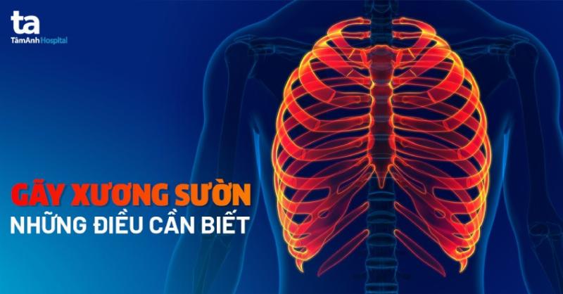 Đau nhói vùng ngực - Dấu hiệu rạn xương sườn