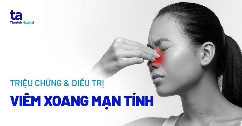 Điều Trị Viêm Xoang Mạn Tính: Hình ảnh minh họa các phương pháp điều trị viêm xoang mạn tính, bao gồm thuốc, rửa mũi và phẫu thuật.