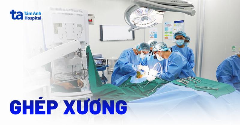 Thời Gian Phục Hồi Sau Mổ Ghép Xương Chân