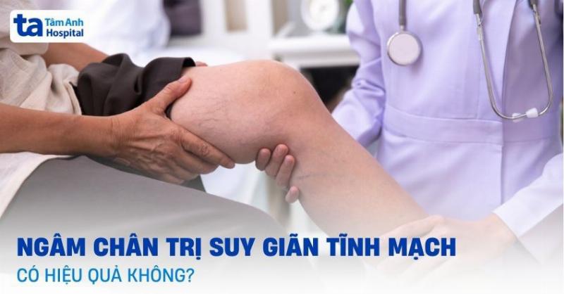 Ngâm Chân Với Nước Ấm Giảm Tê Bì