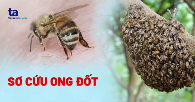 Ong Bắp Cày Có Độc Không? Giải Đáp Chi Tiết