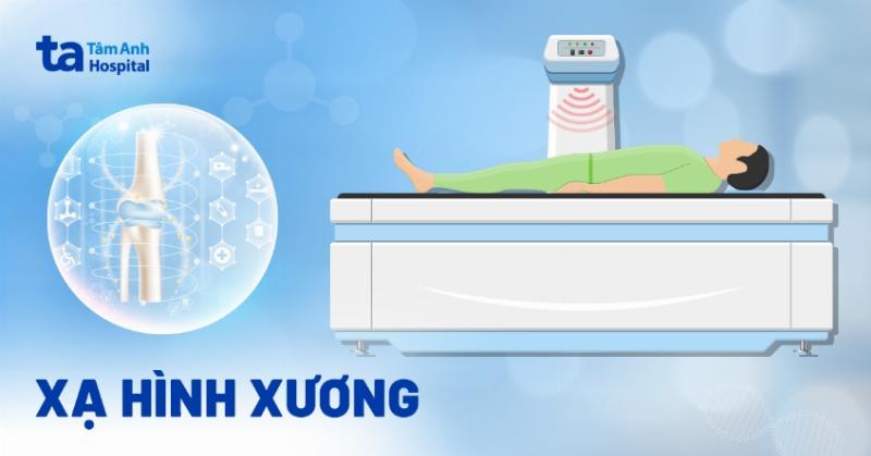 Quy trình thực hiện xạ hình xương