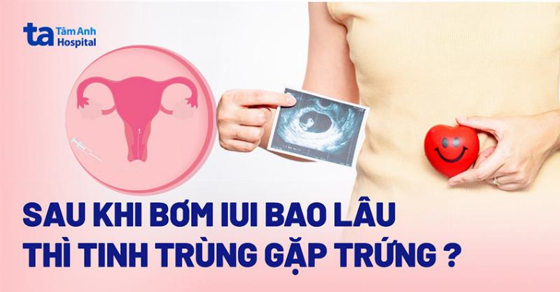 Tinh trùng gặp trứng sau IUI