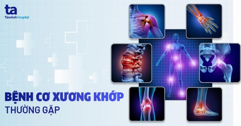 Triệu chứng bệnh xương khớp thường gặp