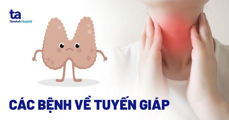 Triệu chứng thiếu iod - Mệt mỏi, tăng cân, táo bón...