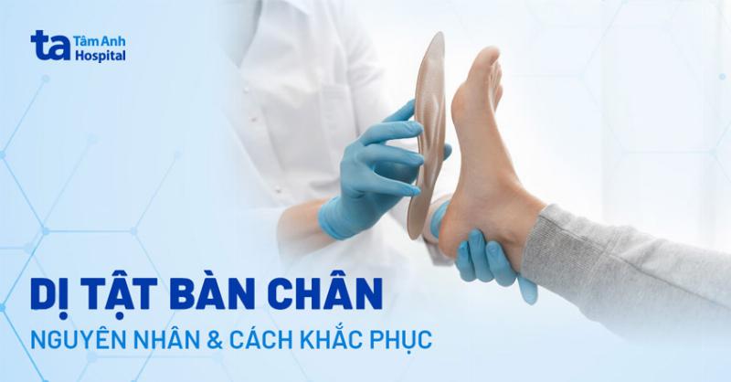 Nguyên nhân xương bàn chân bị lồi