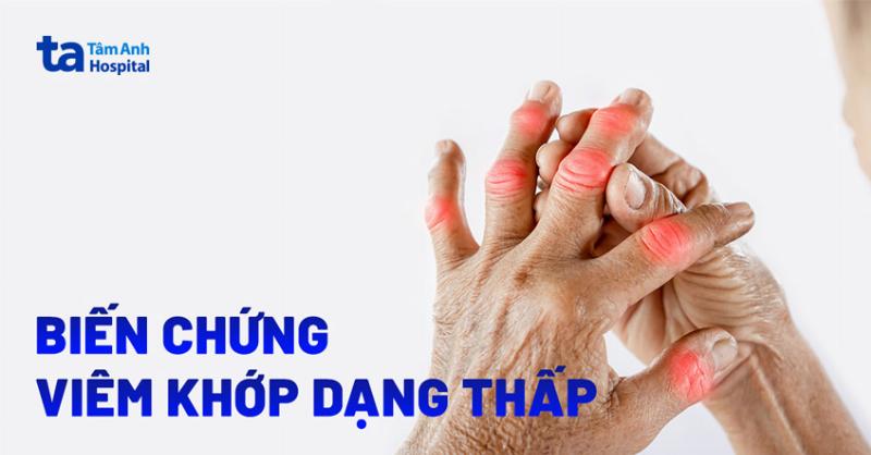 Biến Chứng Của Đau Xương Khớp