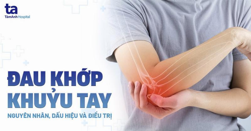 Hình ảnh minh họa khớp xương vai và khuỷu tay