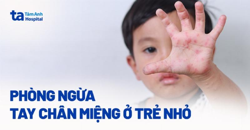 Nguyên Nhân Bị Tay Chân Miệng: Hiểu Rõ Để Phòng Tránh