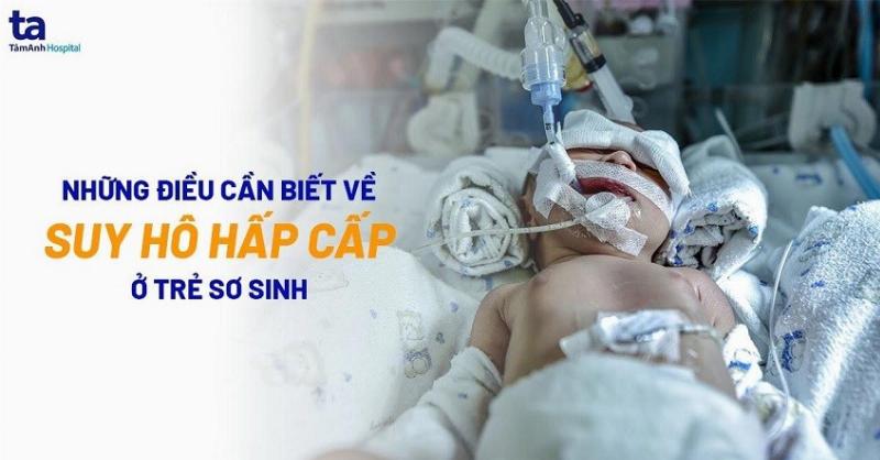 Suy Hô Hấp Sơ Sinh: Nguyên Nhân, Triệu Chứng và Cách Xử Lý