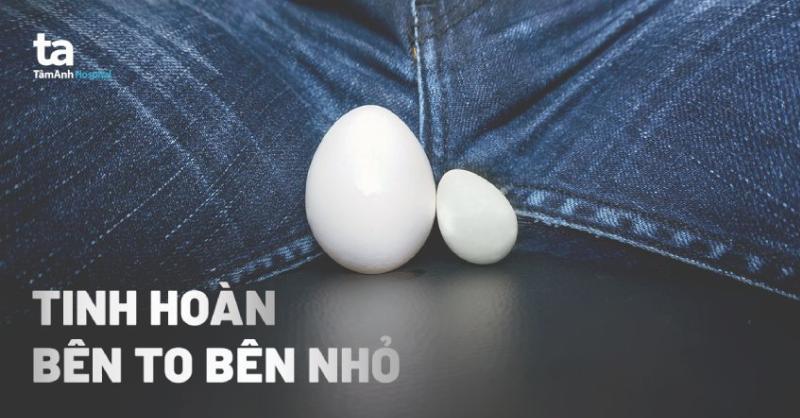 Tinh hoàn bên to bên nhỏ: Nguyên nhân