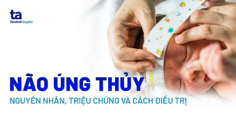 Hiểu rõ về não úng thủy thể nhẹ