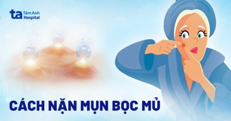 Mụn Sinh Lý: Nguyên Nhân, Cách Trị và Phòng Ngừa, Chăm Sóc Da Mụn Sinh Lý