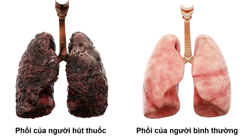 Tác Hại Khói Thuốc Lá Đến Phổi
