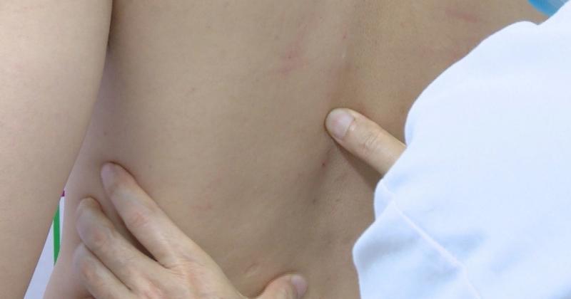 Thầy Lang Nắn Xương Khớp Ở Hà Nội: Lựa Chọn, Kinh Nghiệm và Lưu Ý Quan Trọng