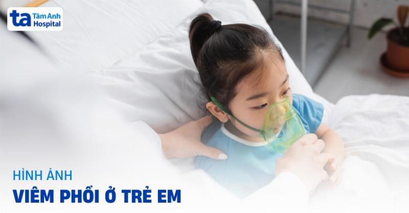 Hình ảnh bệnh viêm phổi