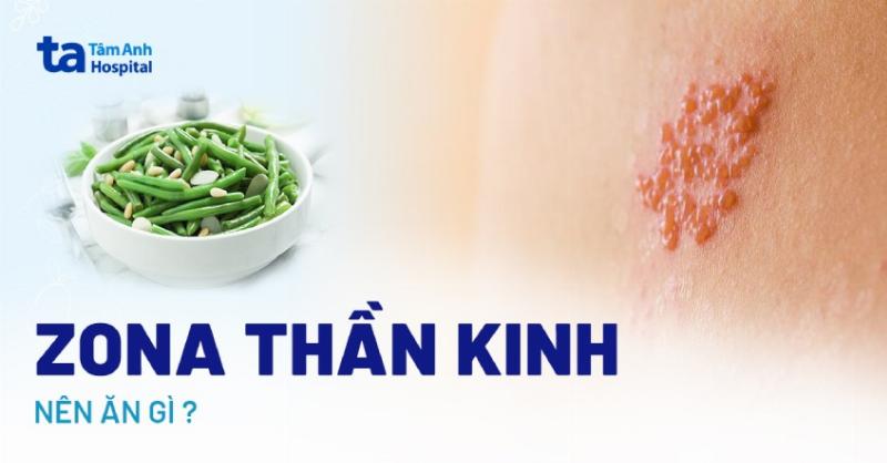 Chế độ ăn uống cho người bị zona