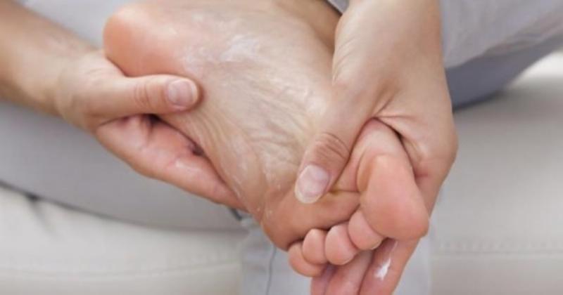 Cách Khắc Phục Tay Chân Bị Lột Da